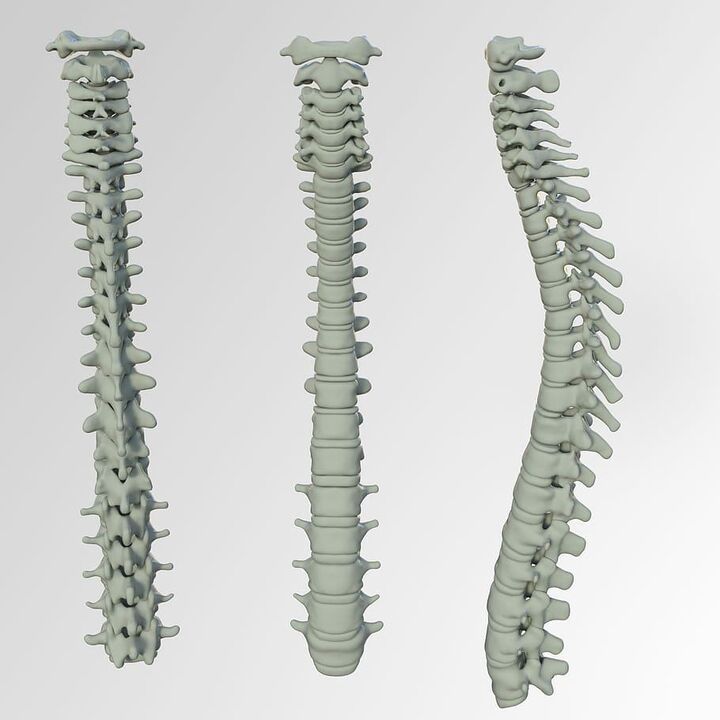 Spine scheme