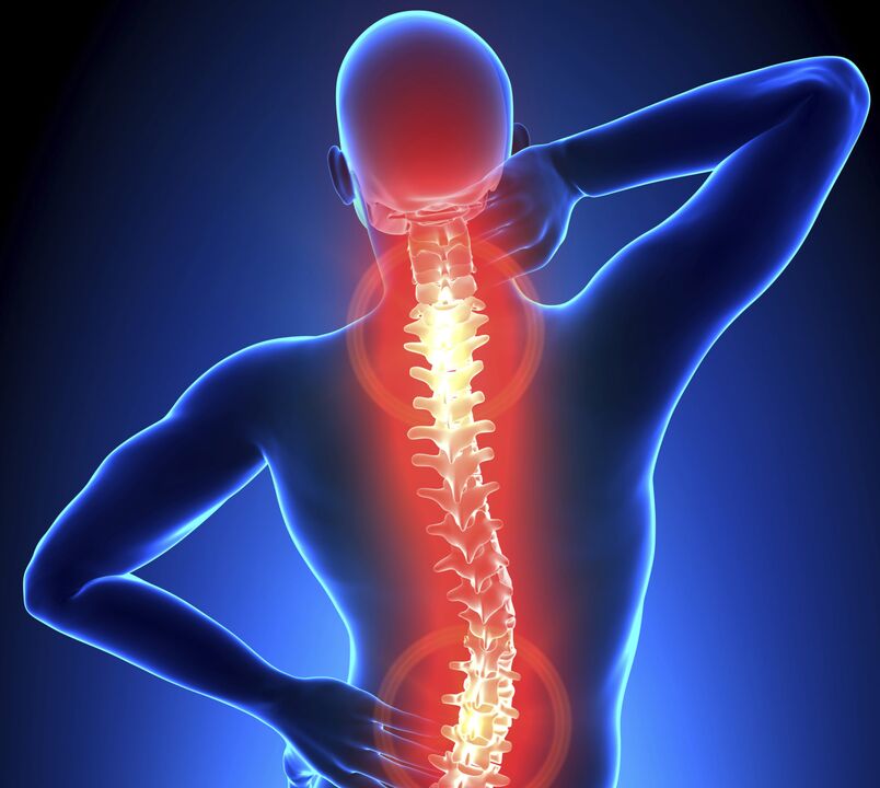 Osteochondrosis of spine