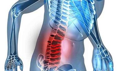 Signs and symptoms of lumbar osteochondrose