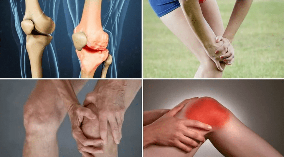 Symptoms of arthrosis
